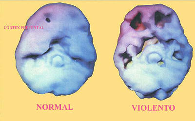 Violencia reflejada en el cortex prefrontal